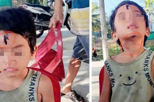 Kiên Giang: Chính quyền thông tin về vụ bé gái 6 tuổi nghi bị cha dượng bạo hành