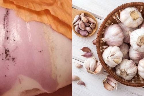Tại sao nên 'đoạn tuyệt' hành, tỏi khi có đốm đen dù không bị hỏng?