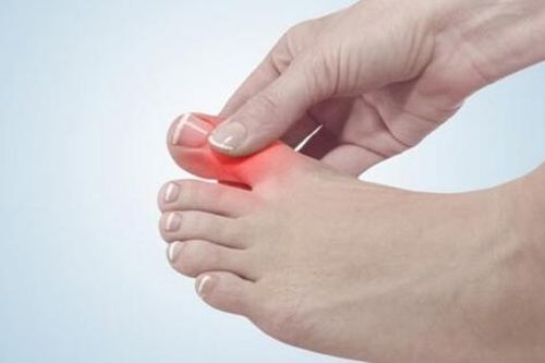 Cách đơn giản hạn chế cước chân tay mùa lạnh