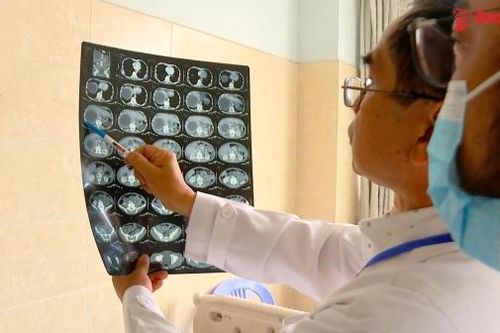 Bệnh nhân ung thư gan nhập viện tăng cao