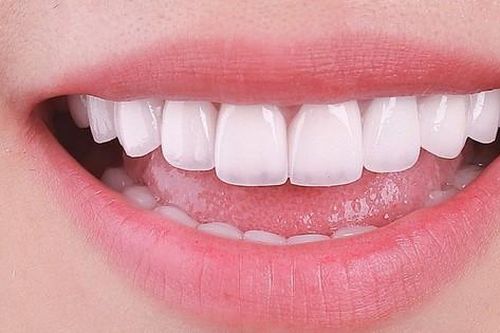 Những việc làm cực kì có hại cho men răng