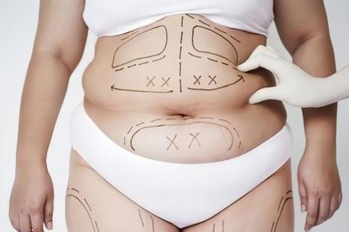 Nỗi ám ảnh vóc dáng hoàn hảo và những bi kịch sau phẫu thuật giảm cân