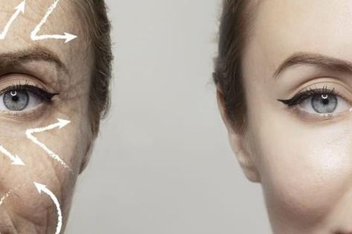 Tuổi nào khiến collagen giảm gây lão hóa da và cách khắc phục