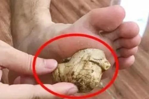 Phụ nữ bôi một ít 'gừng' vào lòng bàn chân trước khi đi ngủ, nếu kiên trì thực hiện, 4 lợi ích này sẽ đến với bạn