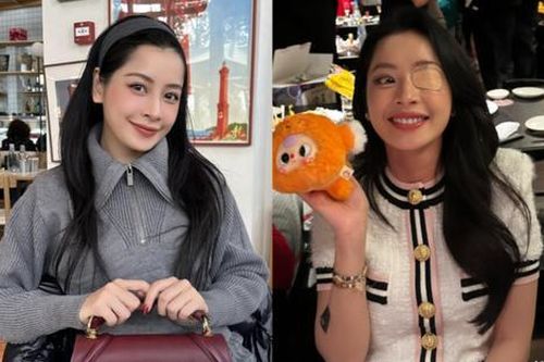Chi Pu đeo băng gạc che mắt, netizen lo lắng cho sức khỏe của nữ ca sĩ