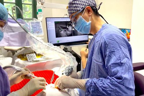 AI trong cấy ghép Implant tại Elite Dental: Tối ưu thời gian, tăng độ chính xác