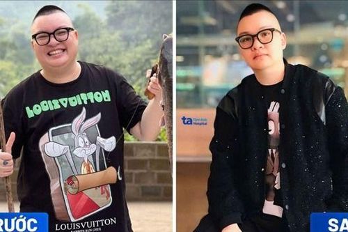 Giảm cân chuẩn y khoa mang đến giải pháp bền vững cho thị trường làm đẹp