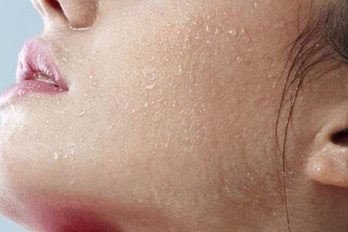 Thói quen xấu khiến da khô bong tróc trong mùa đông