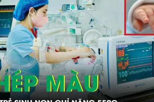 Phép màu: Cứu sống trẻ sinh non chỉ nặng 550g trong tình trạng nguy kịch
