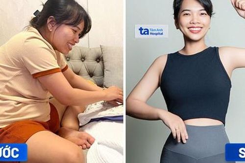 Nhiều phụ nữ có thân hình mơ ước nhờ giảm cân chuẩn y khoa