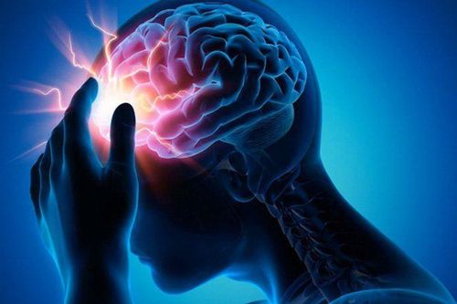 Bé gái bị đau đầu, động kinh, đi khám bác sĩ phát hiện mắc dị dạng mạch máu não