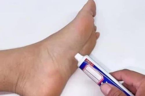 Kem đánh răng bôi vào lòng bàn chân có tác dụng rất tốt, giải quyết được nhiều vấn đề trong gia đình