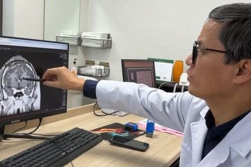 Giảm 90% số cơn động kinh cho nam thanh niên 21 tuổi mắc bệnh từ lúc chào đời