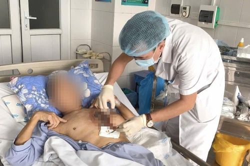 Người đàn ông hoại tử mô cơ ngực sau khi dọn nghĩa trang