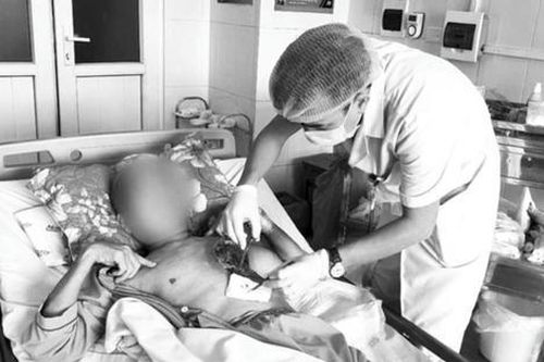 Người đàn ông hoại tử mô cơ ngực trái do nhiễm nấm sau khi dọn nghĩa trang cuối năm