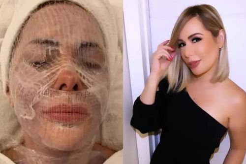 Nữ người mẫu chi 1,5 tỷ mỗi tháng cho các liệu pháp làm đẹp 'độc lạ'