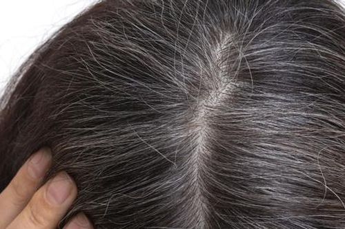 Bổ sung vitamin và khoáng chất giúp ngăn ngừa tóc bạc sớm