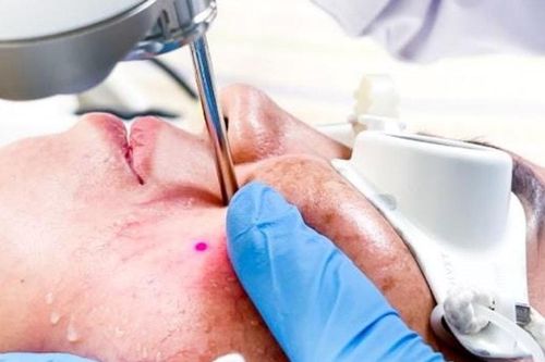 'Tiền mất, tật mang' từ mỹ phẩm chứa corticoid
