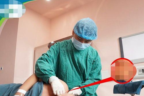 Tết đến, lại gia tăng tai nạn sinh hoạt ở trẻ em
