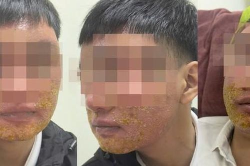 Làm đẹp da ở spa chơi Tết, nam thanh niên phải vào bệnh viện điều trị