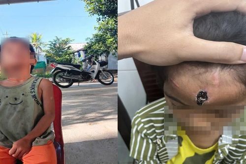 Kiên Giang: Khởi tố 'cha dượng' hành hạ con riêng của vợ