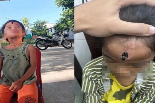 Cha dượng hành hạ con riêng 7 tuổi của vợ