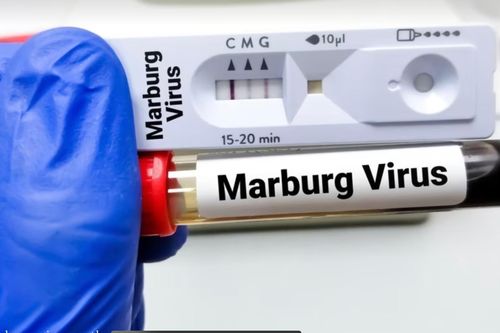 WHO vận chuyển hàng viện trợ y tế đến Tanzania trong bối cảnh dịch virus Marburg bùng phát
