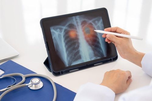 Nguyên nhân bất ngờ khiến nhiều người mắc bệnh COPD