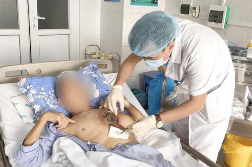 Cẩn trọng với bệnh nấm đen hiếm gặp