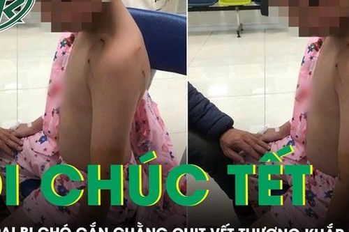 Xót xa bé trai 10 tuổi bị chó cắn khi đi chúc Tết chằng chịt vết thương khắp người