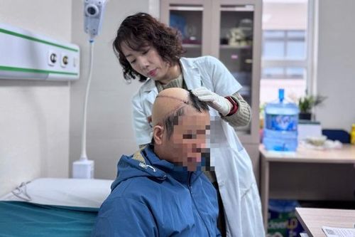 12 giờ 'cân não' cứu người phụ nữ bị ung thư da đầu xâm lấn xương sọ
