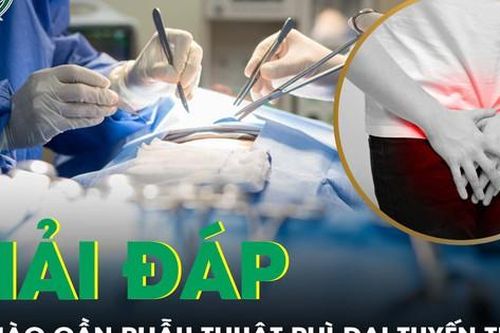Khi nào cần phẫu thuật phì đại tuyến tiền liệt?