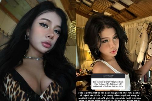 Xuân Ca quyết định chia sẻ chuyện 'thầm kín' về phẫu thuật thẩm mỹ