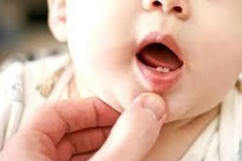 Phân biệt mọc răng với các loại bệnh khác của trẻ