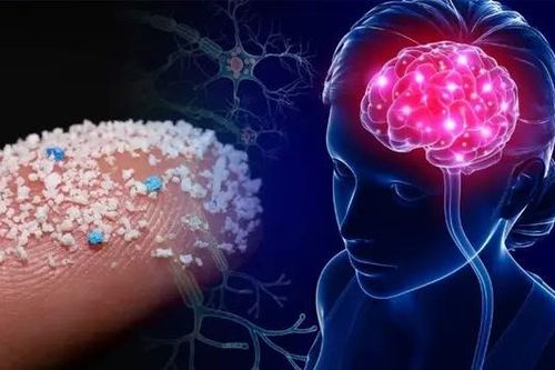 Vi nhựa trong não người có xu hướng gia tăng