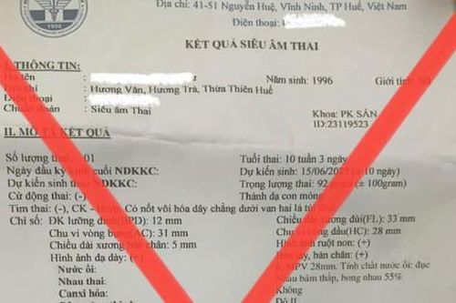 Cảnh báo mạo danh Bệnh viện Trường Đại học Y Dược Huế trả kết quả siêu âm