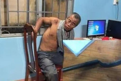 Bắt tạm giam đối tượng dùng rựa tấn công Thượng úy Công an xã