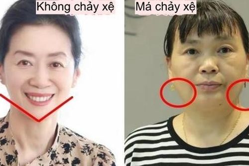 'Da chảy xệ' tố cáo tuổi tác rõ ràng, xem xong so sánh tôi mới hiểu: Càng lớn tuổi càng phải làm điều này!