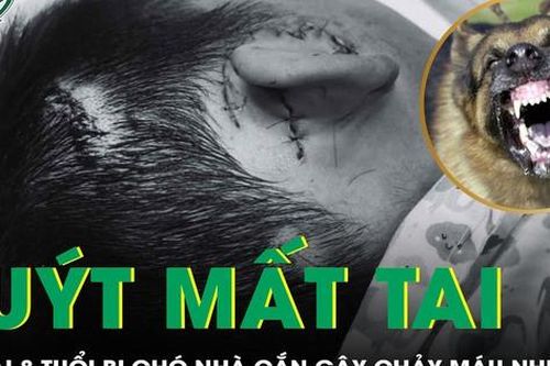 Bị chó nhà cắn, bé trai 8 tuổi suýt bị mất tai