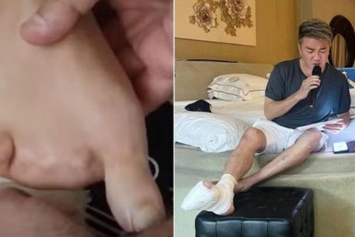 Thông tin ca sĩ Đàm Vĩnh Hưng bị mất 4 ngón chân là sai sự thật