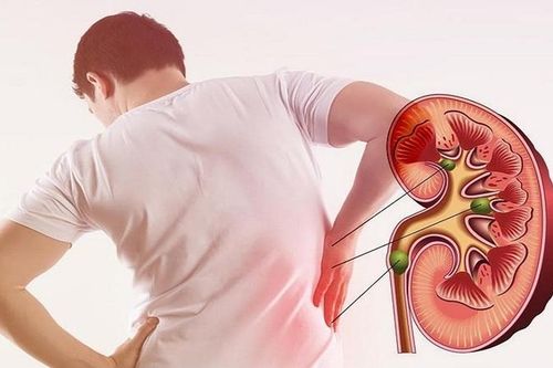 Thành công bước đầu trong nghiên cứu vaccine giúp ngăn ung thư thận tái phát