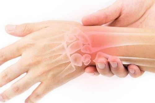 Đau cổ tay sau chấn thương, cảnh giác với tràn dịch khớp cổ tay