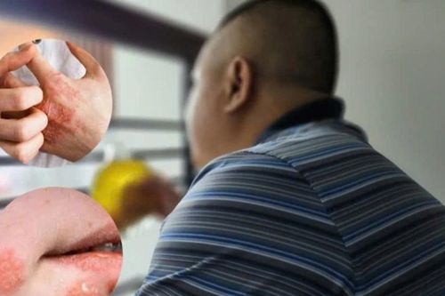 Kiêng khám bệnh sau Tết, nhiều bệnh nhân biến chứng nguy hiểm