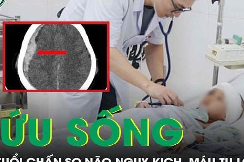 Cứu sống bé 5 tuổi chấn thương sọ não, nguy kịch vì máu tụ lớn