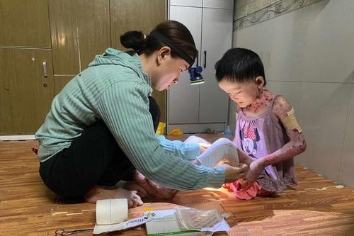 Hơn 102 triệu đồng đến với bé gái 8 tuổi toàn thân lở loét, tứa máu vì căn bệnh quái ác