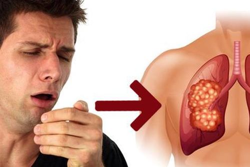Ho dai dẳng là dấu hiệu bệnh gì?