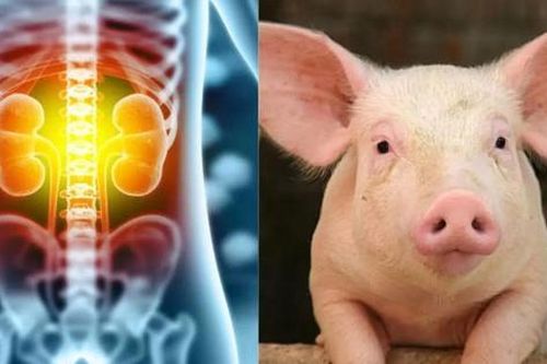 Kỷ lục mới về cấy ghép nội tạng lợn cho người
