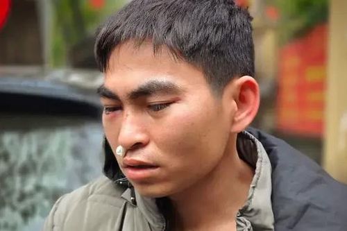 Kết quả giám định thương tích người giao hàng bị đánh