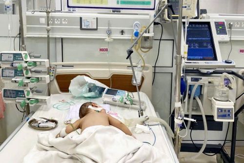 Cứu bé trai 7 tháng tuổi viêm phổi nặng do biến chứng cúm