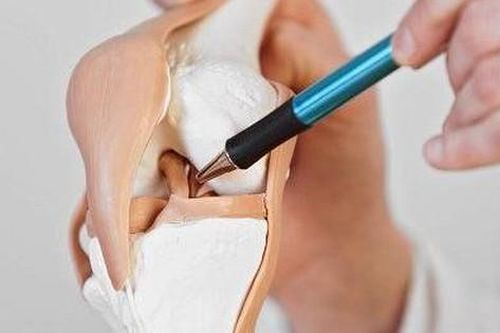 Chấn thương sụn chêm: Nguyên nhân, triệu chứng, điều trị và cách phòng bệnh